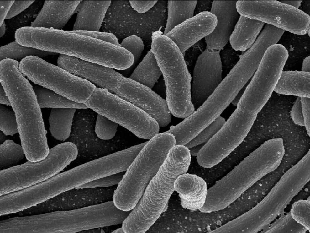 Bacteria
