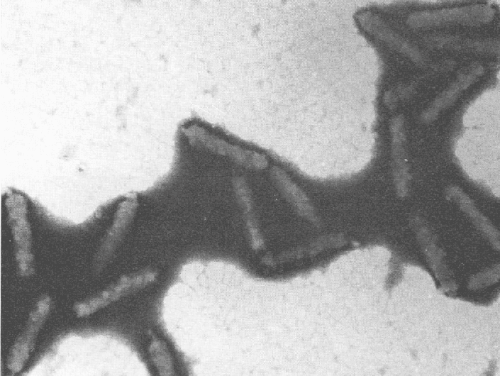 Virus